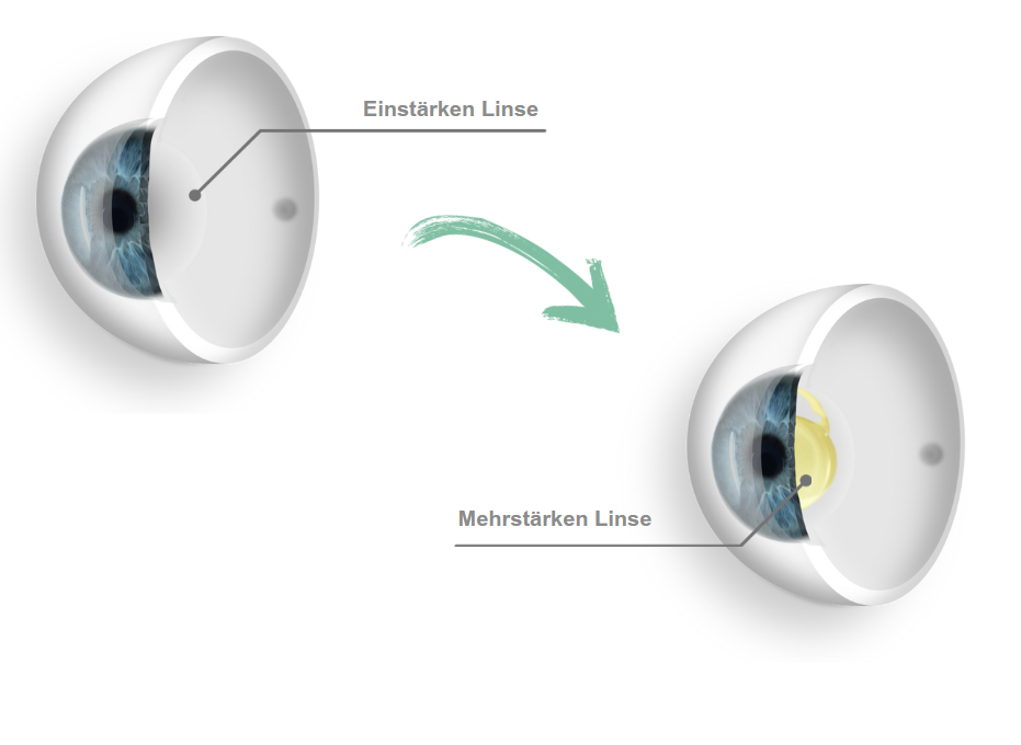 Augenarzt Frankfurt Professor Mehdi Shajari in OP-Kleidung vor dem Augenlaser beim operieren
