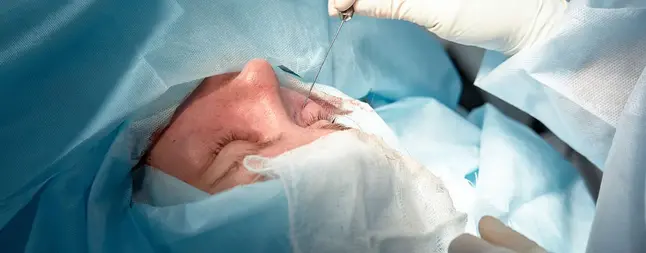 F Schlupflider OP in Frankfurt