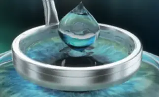  Die Flap Bildung als erster Schritt beim Augenlasern mit LASIK