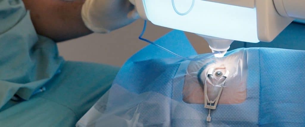 Augenarzt & Augenlasern Frankfurt dr.vision Ablauf der Augenlaser-Operation