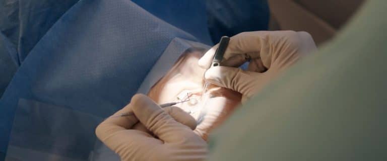 Wie wirkt ein Laser am Auge?