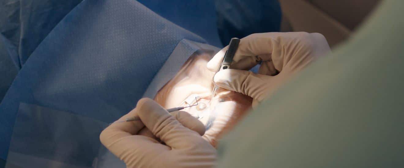 Wie wirkt ein Laser am Auge?