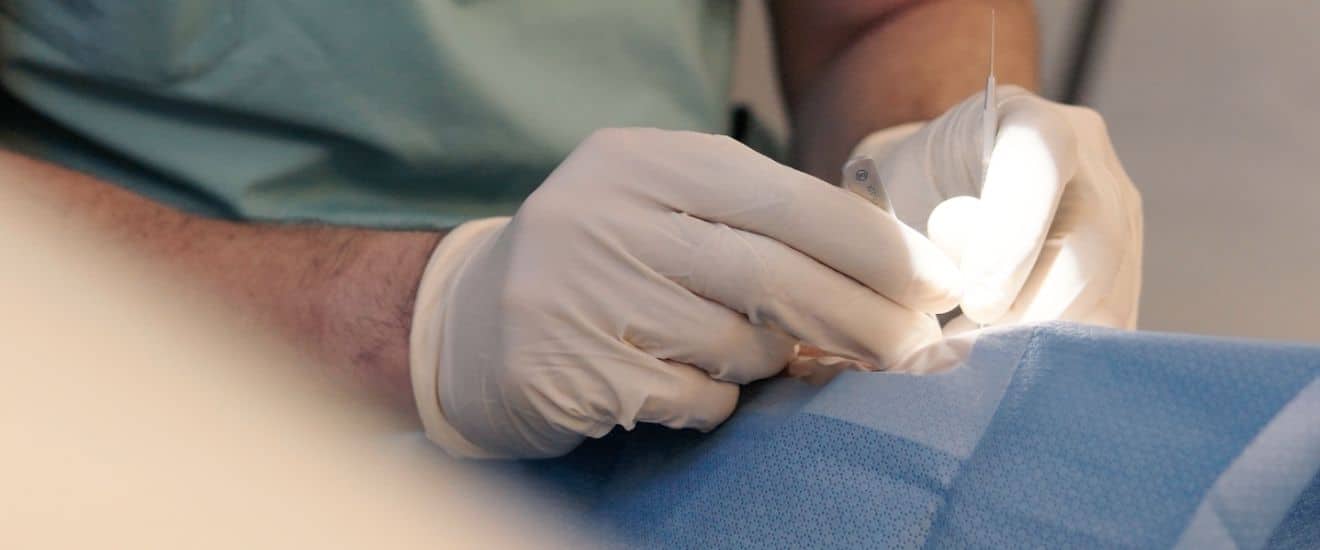 Was ist LASIK und für wen ist das Verfahren geeignet?