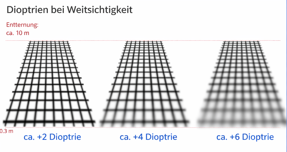 Augenarzt & Augenlasern Frankfurt dr.vision Augenarzt & Augenlasern Frankfurt dr.vision