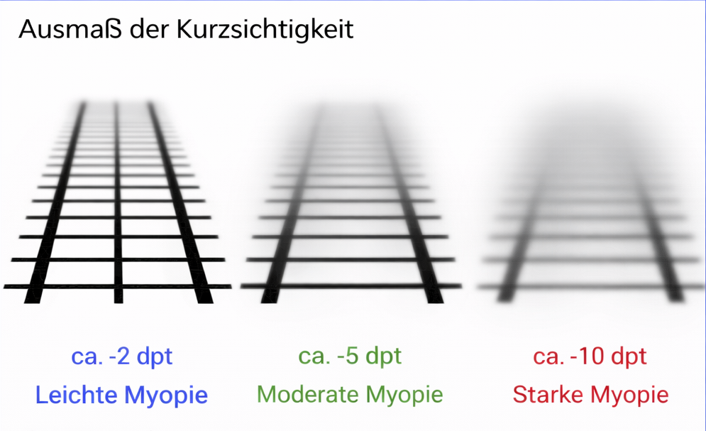 Augenarzt & Augenlasern Frankfurt dr.vision Augenarzt & Augenlasern Frankfurt dr.vision