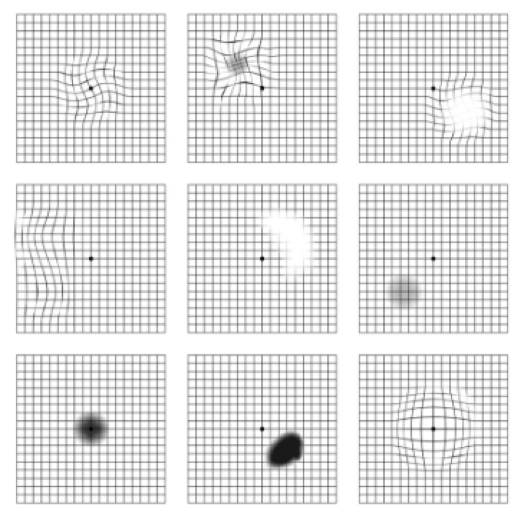 Augenarzt & Augenlasern Frankfurt dr.vision Augenarzt & Augenlasern Frankfurt dr.vision